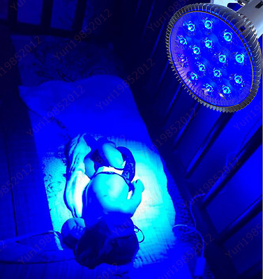 #ad 485nM 15 Watts Baby Care Neonatal Jaundice Phototherapy LED Blue Ray Light Lamp