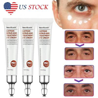#ad 3x Eye Cream Instant Remove Eye Bags Dark Circles Anti Wrinkle Depuffing Firming