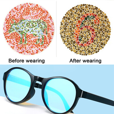 #ad Multifunctional Red Green Color blindness Glasses Foldable Colorblind Eyewear