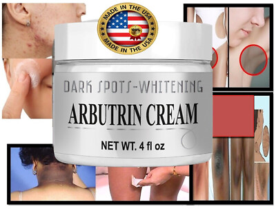 #ad Best Cream Dark Spot Whitening Lightening Cream Dark Spots Face Intimate Parts