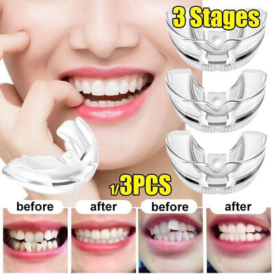 #ad 3 Stage Straighten Tool Dental Orthodontic Teeth Corrector Braces Tooth Retainer