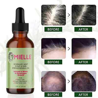 #ad HAIR GROWTH ORGANIC Essential Oil With Rosemary Treatment for Split Ends