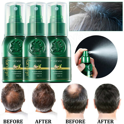 #ad 3pcs Hair Growth Serum Spray Hair Oil Regrowth Anti Loss Treatment For Men Women