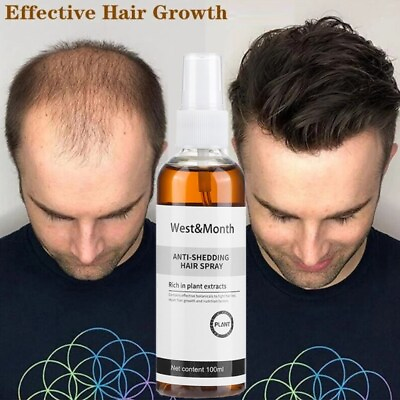 #ad Anti Shedding Hair Spray Hair Loss Treatment Solution Hair Growth Spray For Men